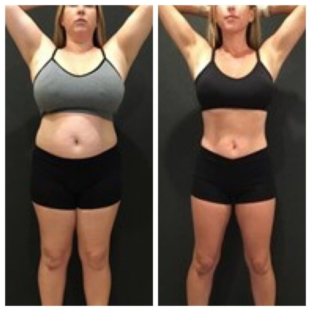 gastric balloon near me
