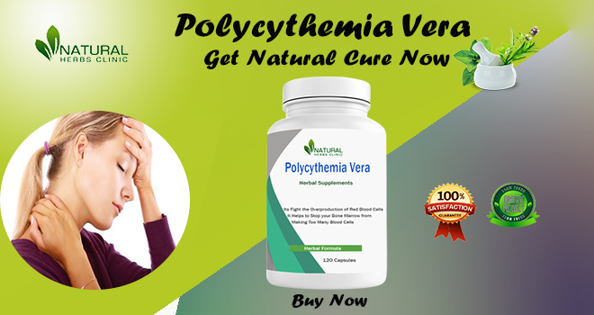 Polycythemia Vera Herbal Remedies