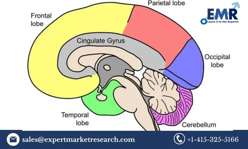Pseudobulbar Affect Treatment Market