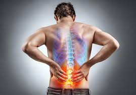 Sciatica