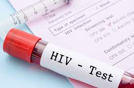 Hiv Testing Jacksonville